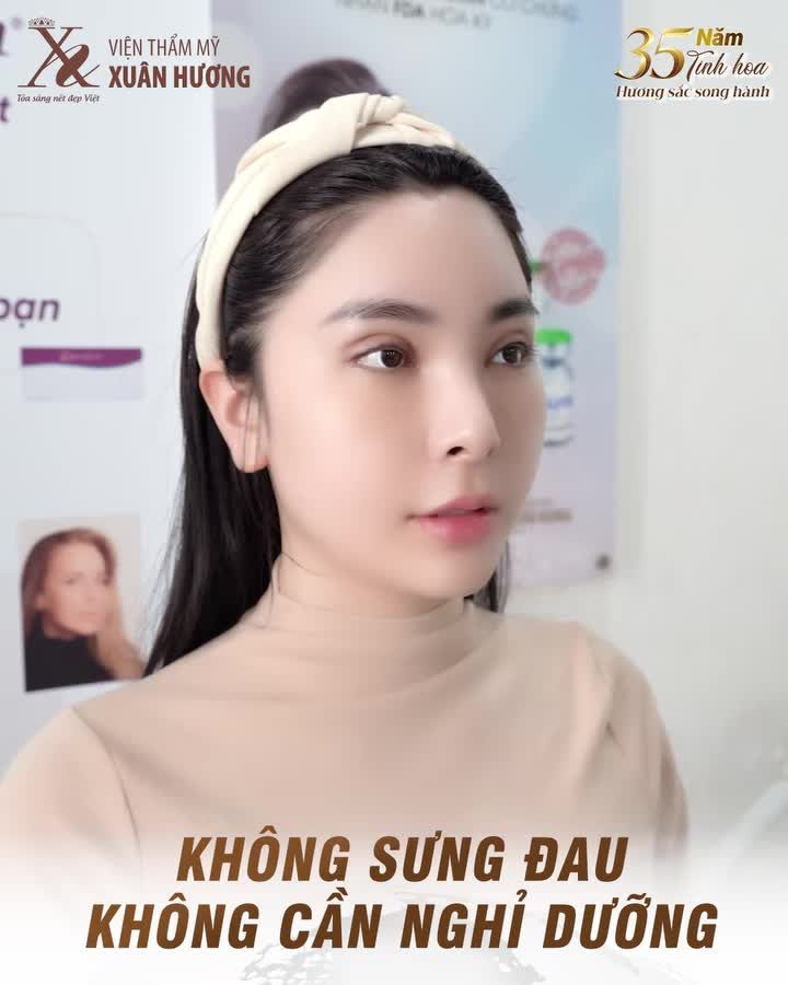 Có ngay mắt 2 mí đều đẹp Đôi mắt to tròn trẻ trung