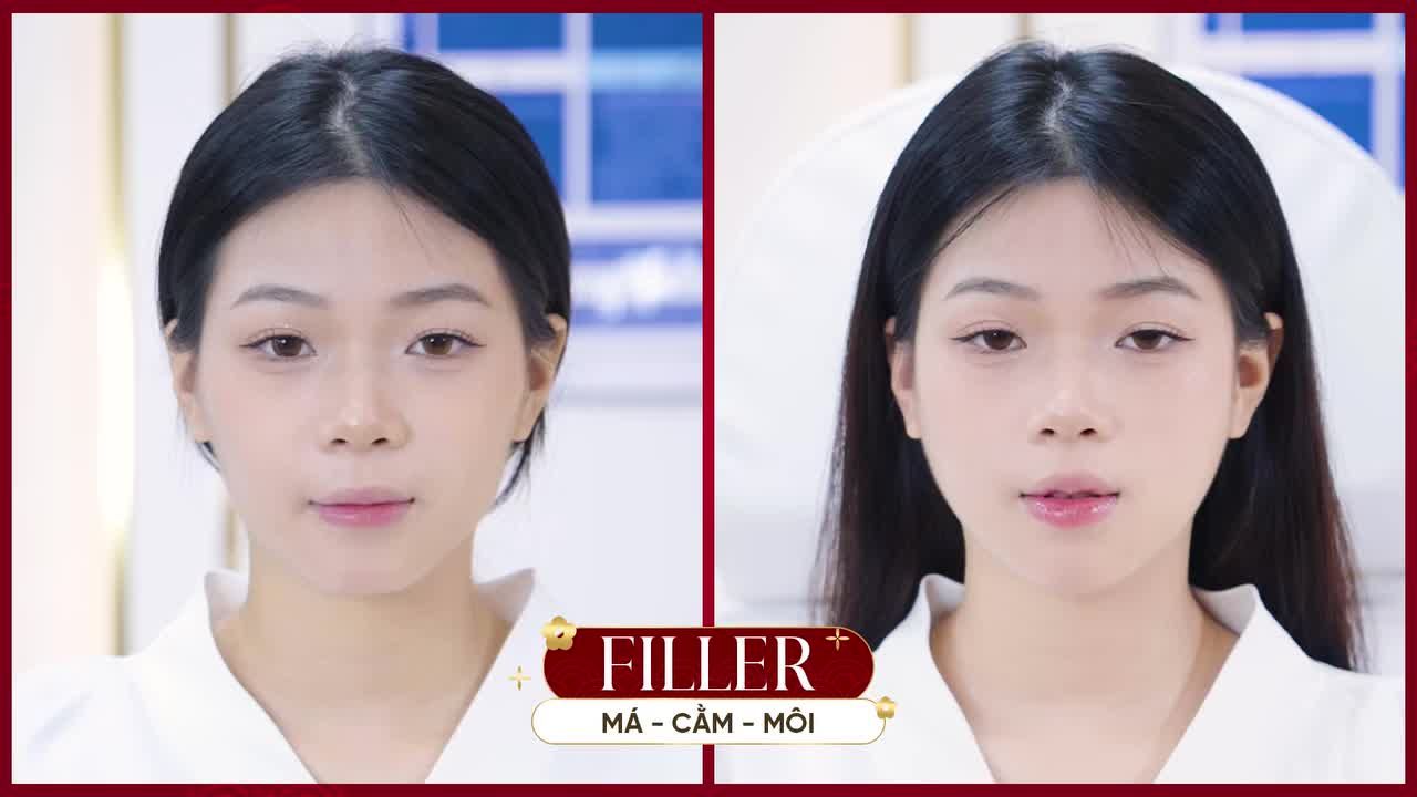 BIẾN HÌNH RẠNG RỠ – SẴN SÀNG ĐÓN TẾT VỚI ƯU ĐÃI FILLER TỚI 50%