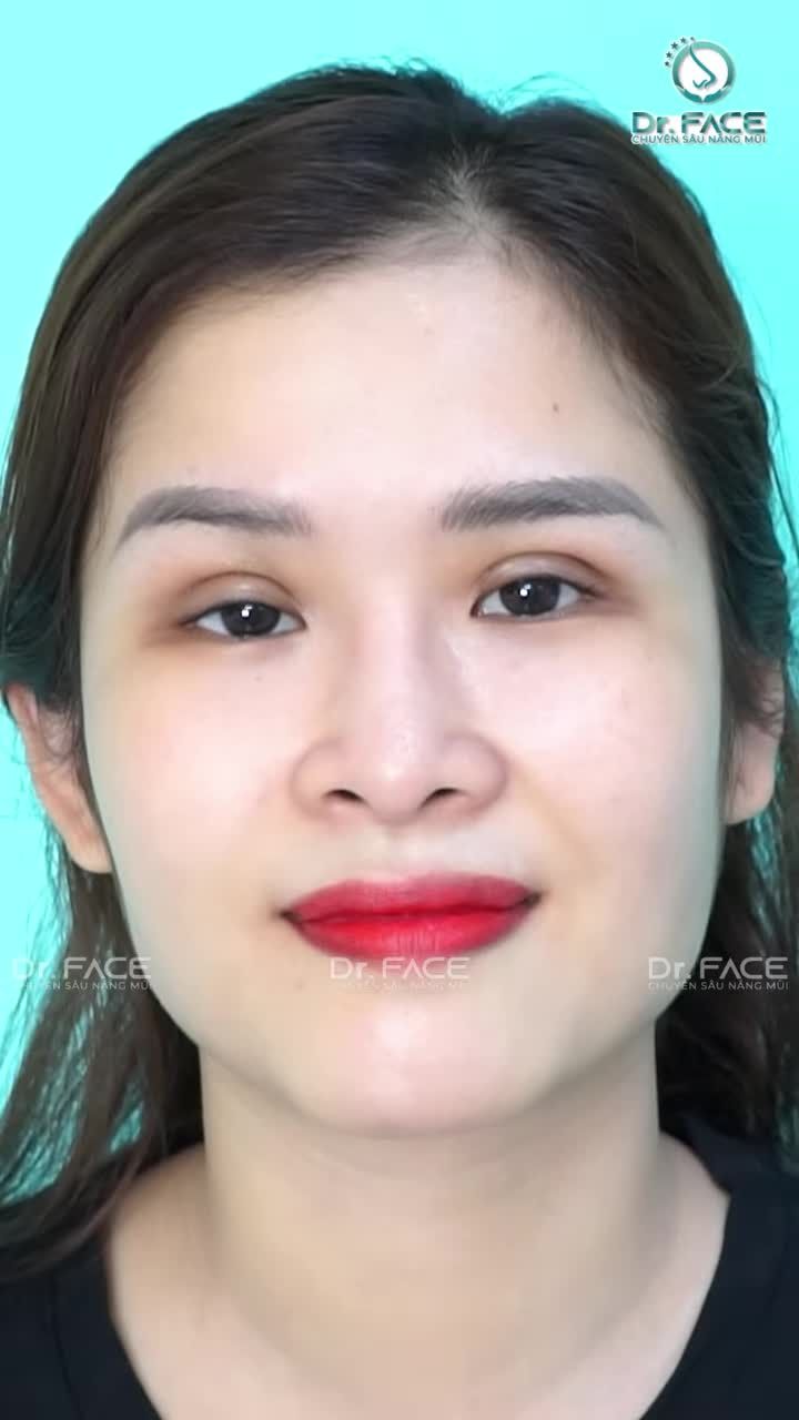 BIẾT BS là CHỐT LÀM MŨI MẮT luôn đâu cần nghĩ?