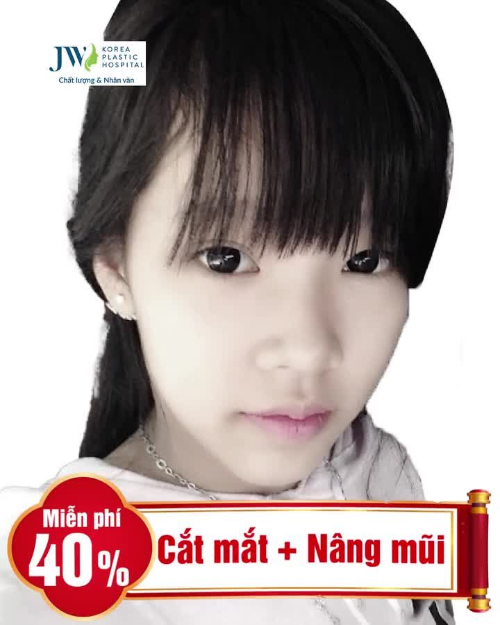 TOP 5 CA CẮT MẮT + NÂNG MŨI THAY ĐỔI THÀNH HOTGIRL NGOẠN MỤC TẠI JW