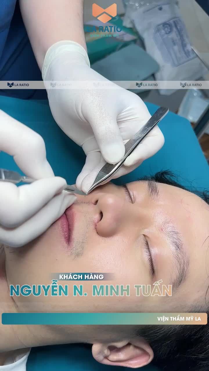 Còn bạn đã sẵn sàng cho sự thay đổi của bản thân chưa? Hình ảnh thực tế trước và sau thực hiện của khách hàng nhà La Ratio là một minh chứng rất cụ thể.