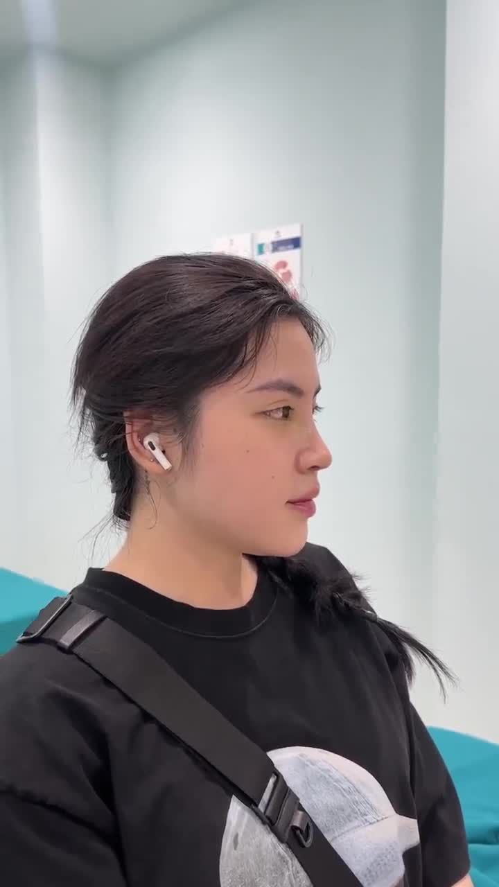Khách hàng Võ Ngọc Gia Ân với chiếc mũi:
