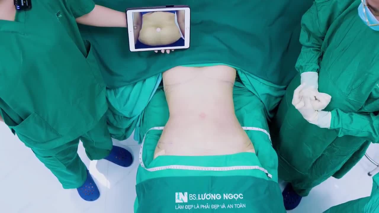 Vòng 2 to bè, mỡ thừa và phình lớn ở bụng dưới – là tình trạng của bạn khách hôm nay.