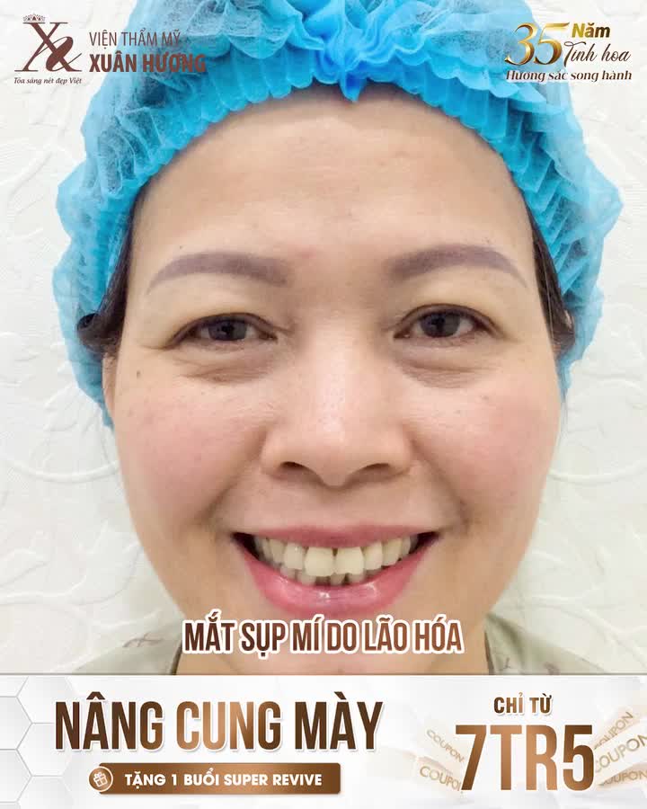 NÂNG CUNG MÀY – “BÍ QUYẾT” GIỮ GÌN NÉT TƯƠI TRẺ