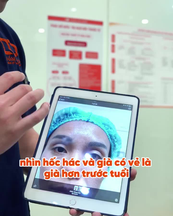 Đôi mắt trũng sâu, thiếu sức sống?
