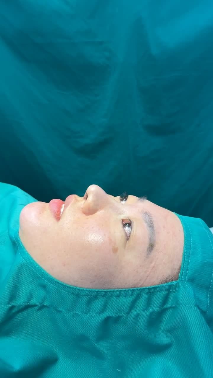 Case mũi cấu trúc surgiform cho bạn gái đến từ Hàn Quốc!!