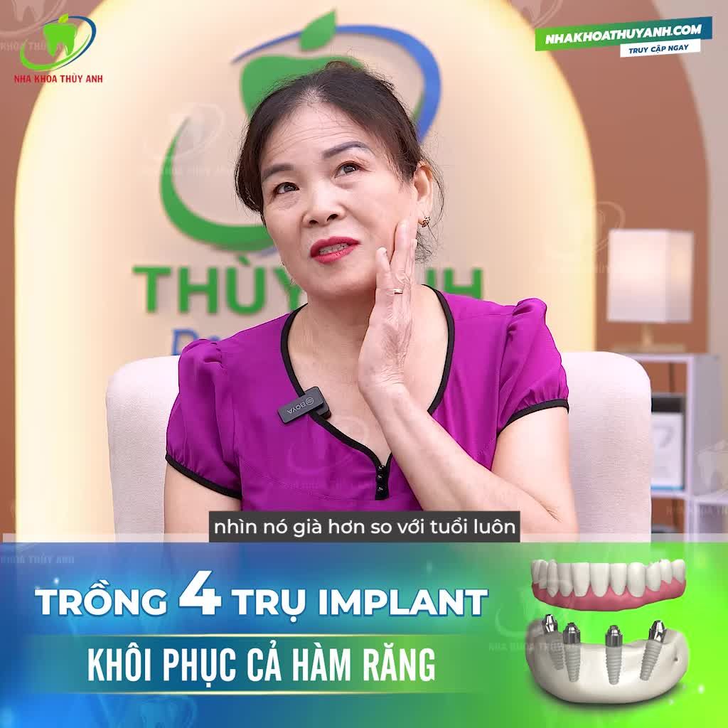 TRỒNG RĂNG TOÀN HÀM TÌM LẠI NỤ CƯỜI RẠNG RỠ SAU 15 NĂM MẤT RĂNG