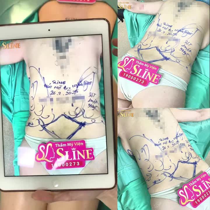 TẠM BIỆT EO BÁNH MÌ – ĐÓN CHÀO VÒNGEO CON KIẾN!