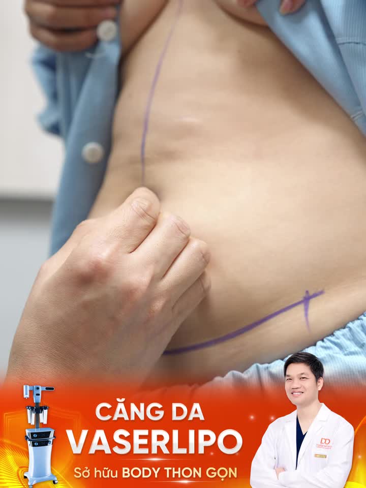 "Lột xác" vóc dáng sau ba lần sinh nở – Hành trình thay đổi đầy ấn tượng!