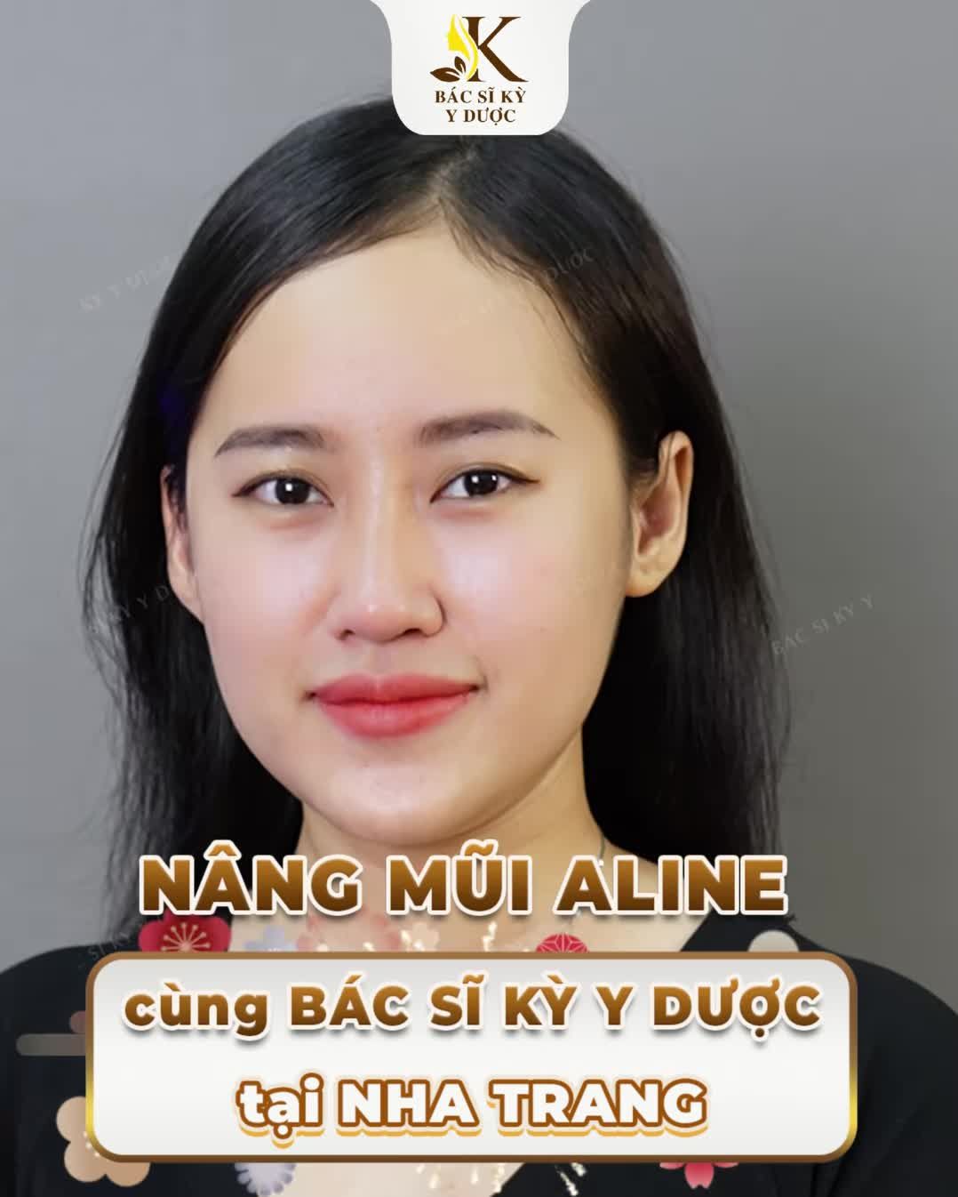 NÂNG MŨI ALINE CÙNG BÁC SĨ KỲ Y DƯỢC TẠI NHA TRANG