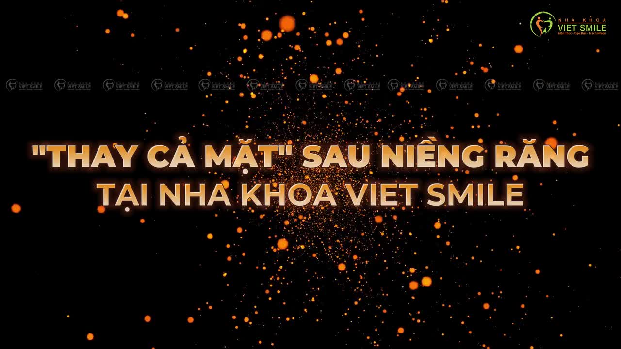 TOP 5 CA RĂNG HÔ - "THAY CẢ MẶT" SAU NIỀNG RĂNG TẠI VIET SMILE