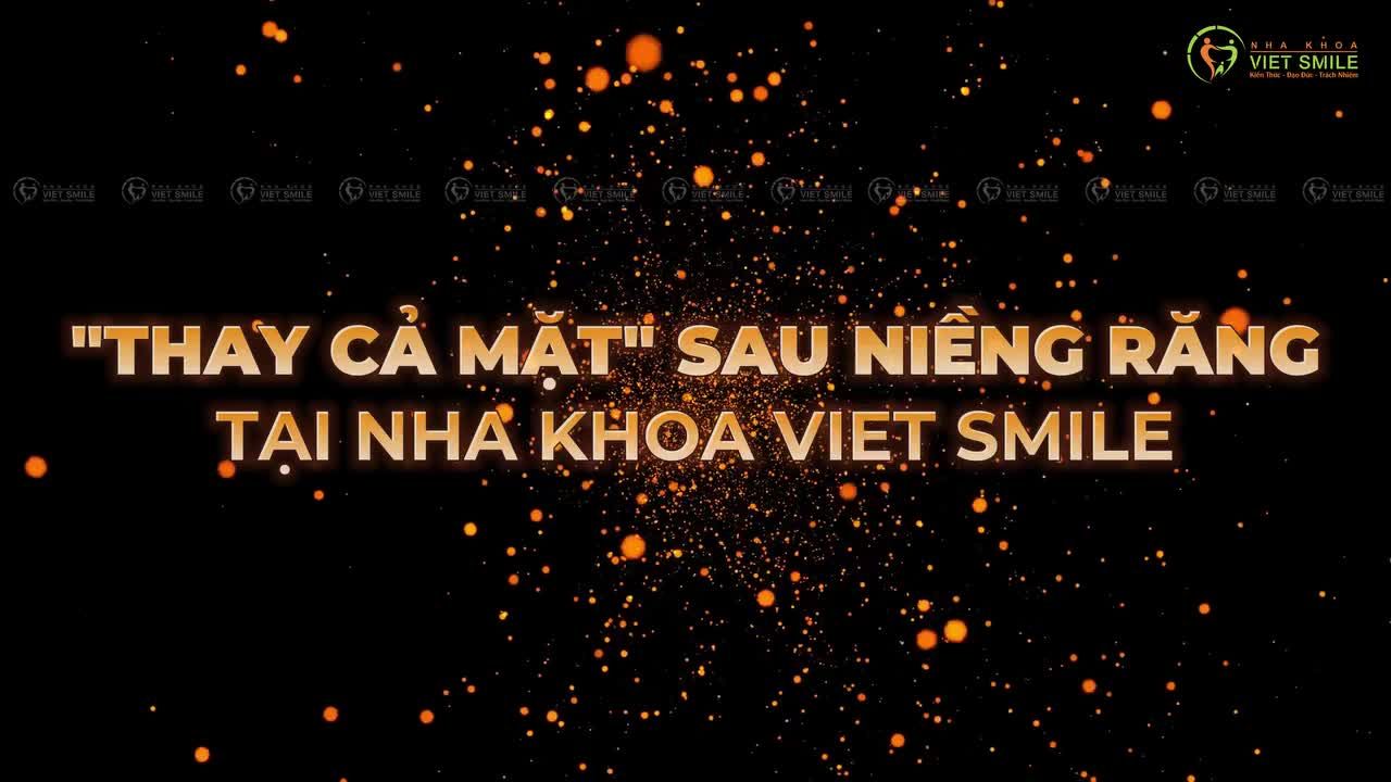 TOP 5 CA RĂNG HÔ - "THAY CẢ MẶT" SAU NIỀNG RĂNG TẠI VIET SMILE