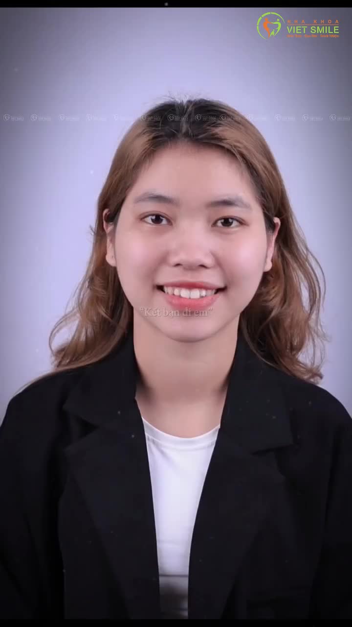 Đến Viet Smile để thực hiện ước mơ có răng đẹp, cười xinh chỉ từ 25 Triệu đi các bạn