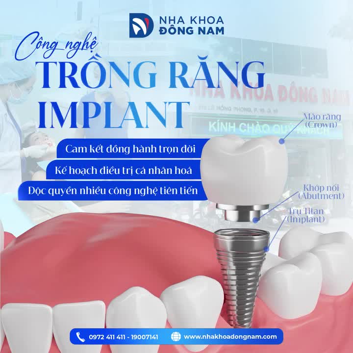 CHƯA MỘT AI HỐI HẬN SAU KHI TRỒNG RĂNG IMPLANT