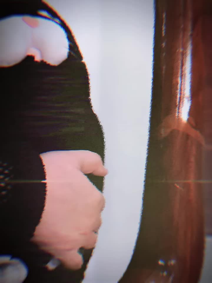 CHỊU ĐAU RĂNG KHÔN NHIỀU NĂM HAY 15 PHÚT NHỔ RĂNG ÊM ÁI?