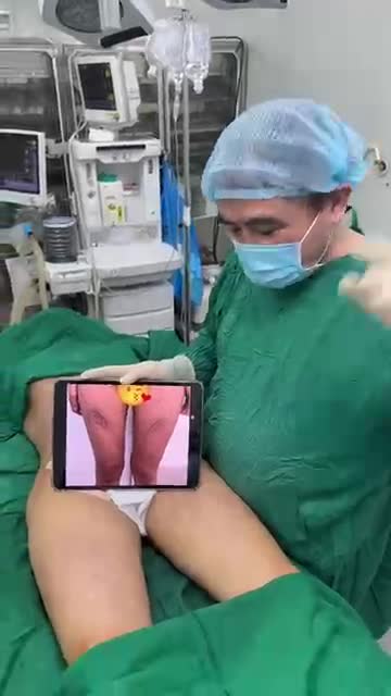 Ca combo chiều ngày 21/3/2025 với Dr Vương gồm sửa, sửa và sửa cho nhiều vùng hút mỡ (trc hút ở nơi khác):