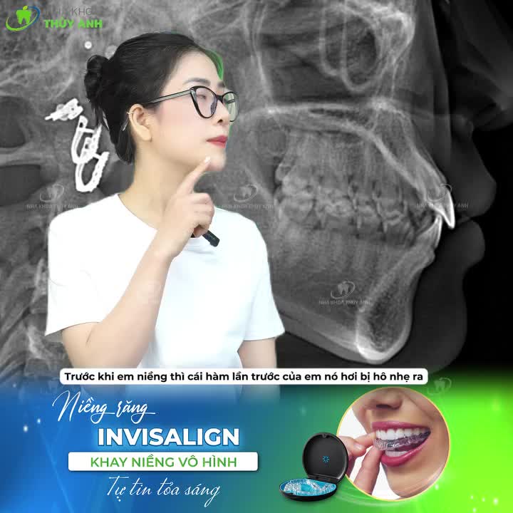 Cùng lắng nghe ngay câu chuyện của Thuỳ Linh qua video dưới đây các bạn nhé!