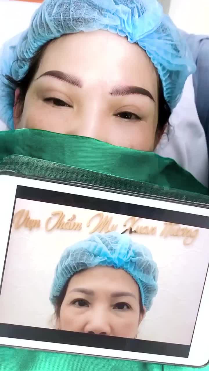 Cùng chiêm ngưỡng ca nâng cung mày vừa được bác sĩ VTM Xuân Hương thực hiện xong! Bạn chấm bao nhiêu điểm cho ca này ạ?
