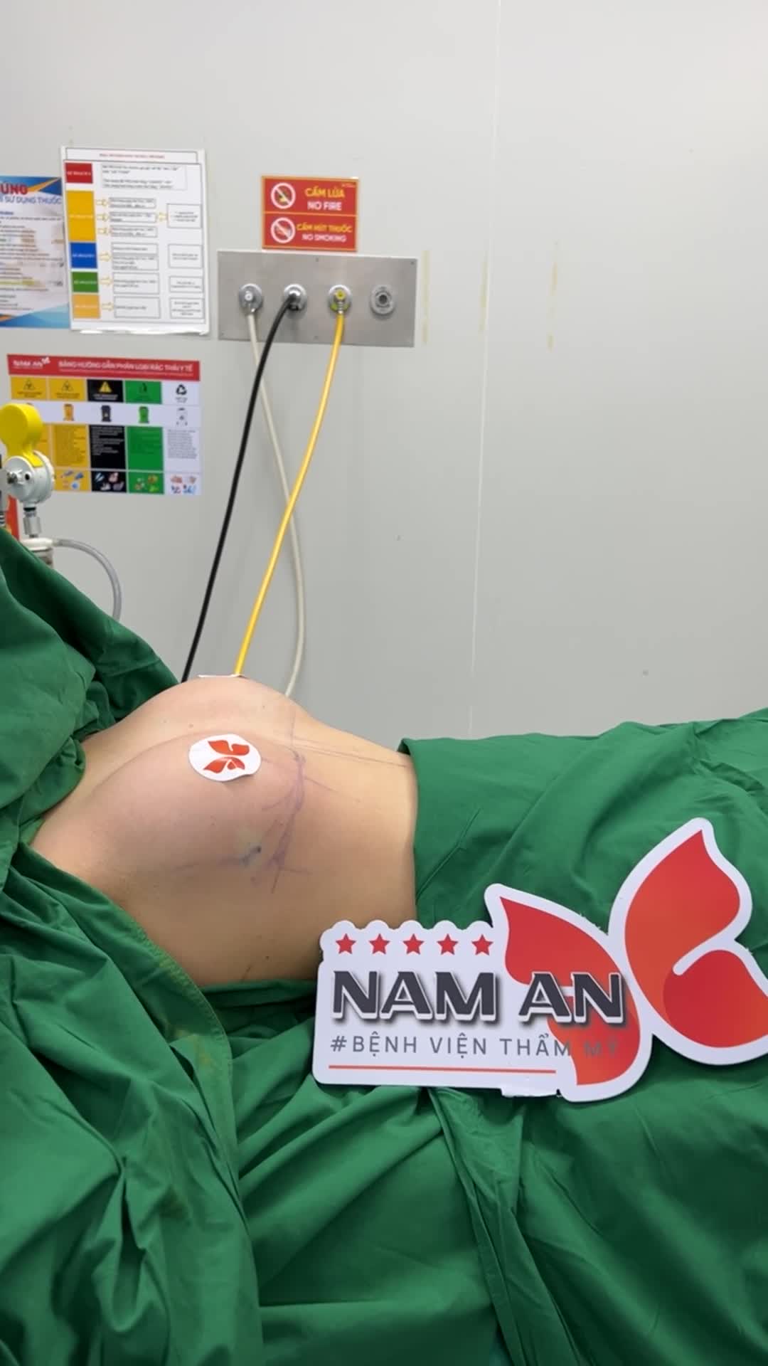 HOÀN THÀNH DÁNG NGỰC MENTOR EXTRA 270cc
