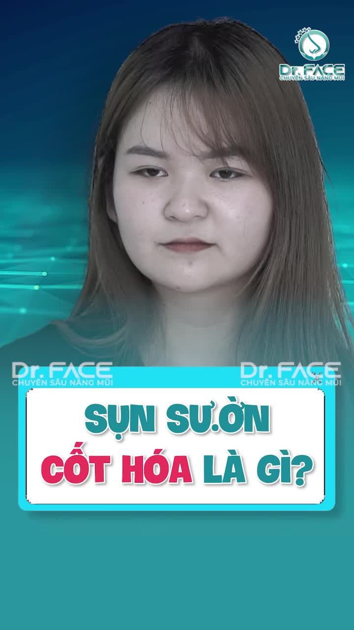 SỤN SƯỜN CỐT HÓA LÀ GÌ?