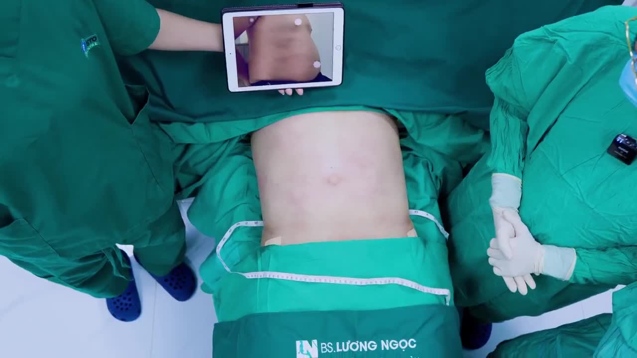 Ekip đã thực hiện hút mỡ bụng cho một anh khách hàng sinh năm 1988, trong khoảng thời gian gần 90 phút.