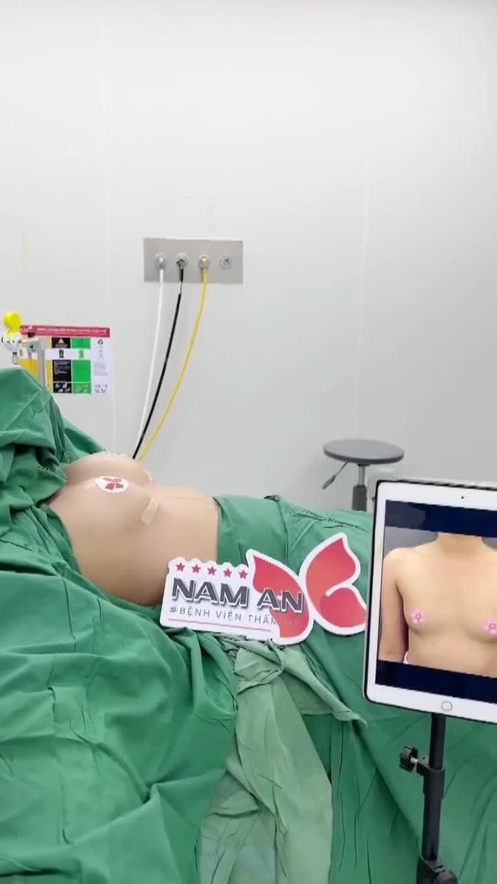 KẾT QUẢ SAU PHẪU THUẬT NÂNG V1 – KHÁCH HÀNG CÓ THỂ VỀ NGAY TRONG NGÀY!