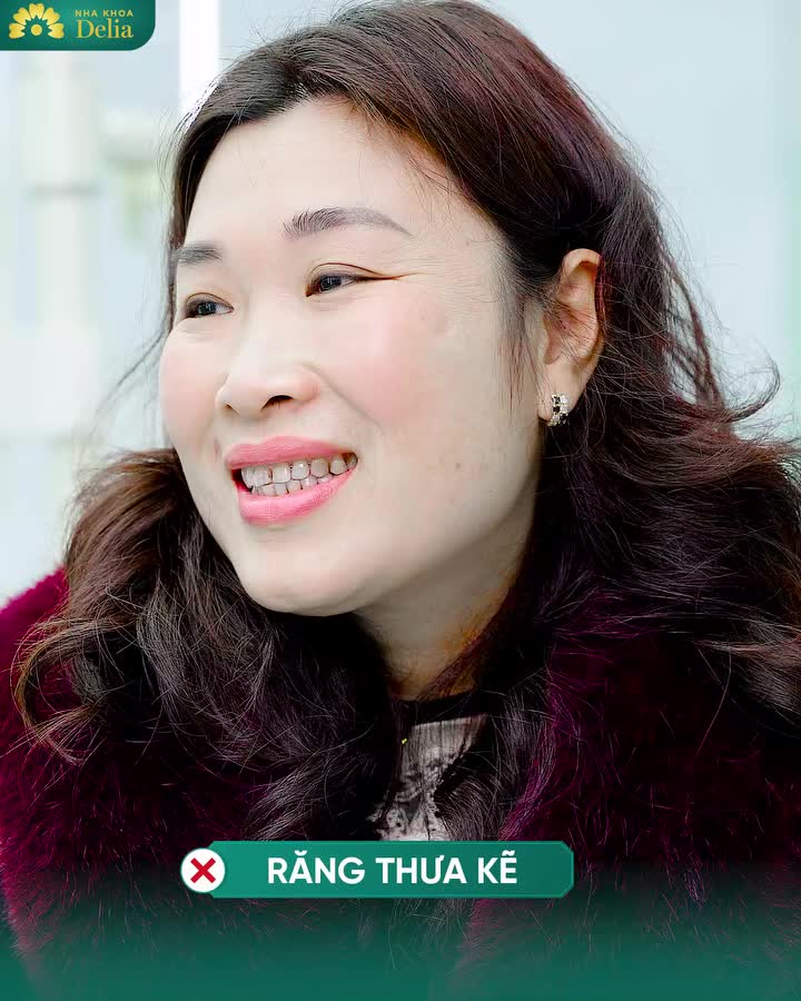 "Ai cũng khen rất là tự nhiên, nhìn nó không đầy miệng răng, mình cũng công nhận là như thế."