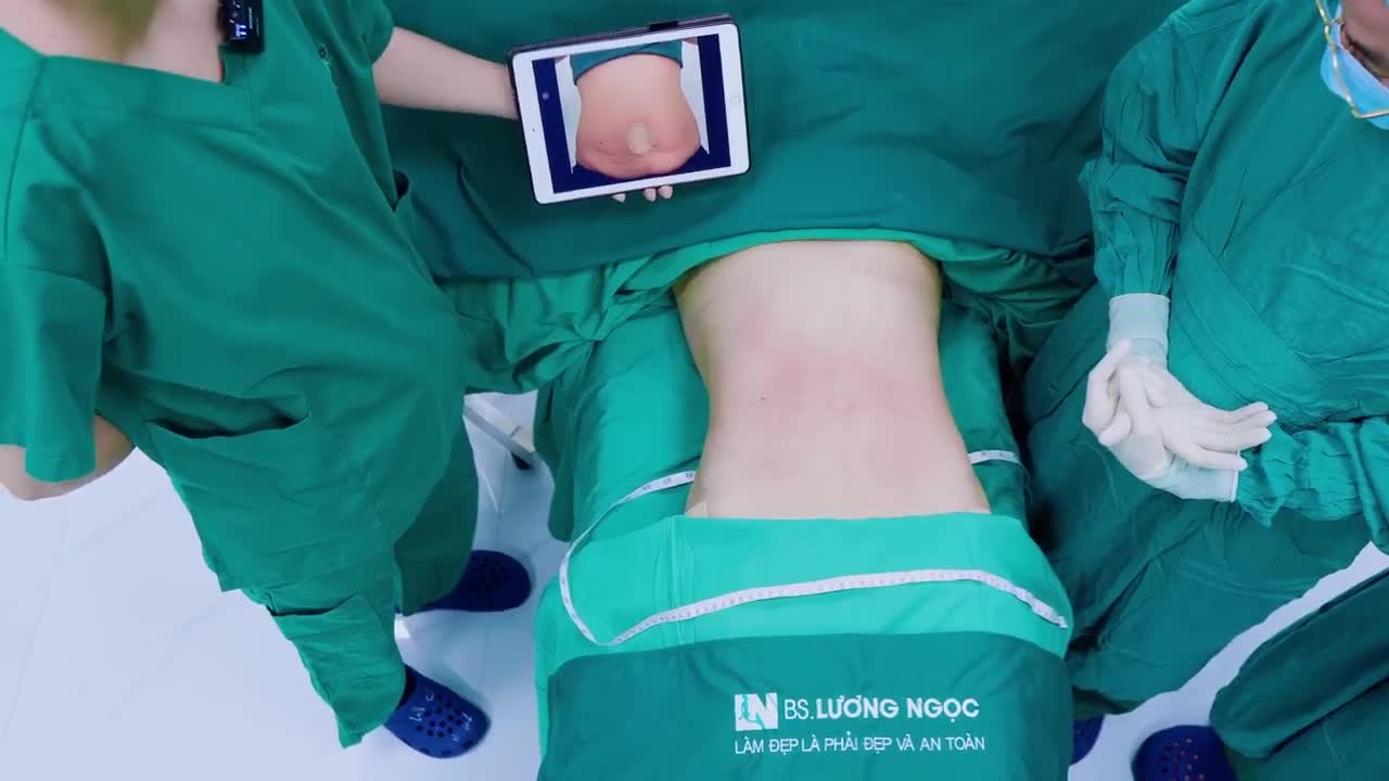 Những khách hàng khi đi hút mỡ có một nỗi lo lớn nhất chính là sẹo sau khi làm.