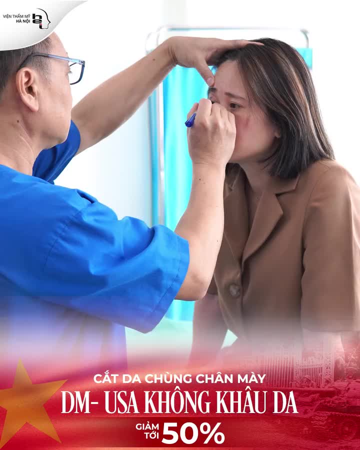 CẮT DA CHÙNG CHÂN MÀY KHÔNG KHÂU DA
