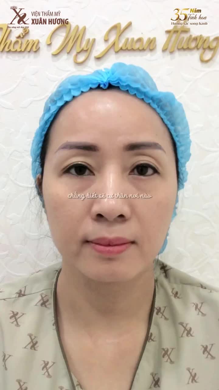 TÁI TẠO ĐƯỜNG NÉT - TRẺ TRUNG BẤT NGỜ VỚI NÂNG CUNG MÀY TẠI VIỆN THẨM MỸ XUÂN HƯƠNG