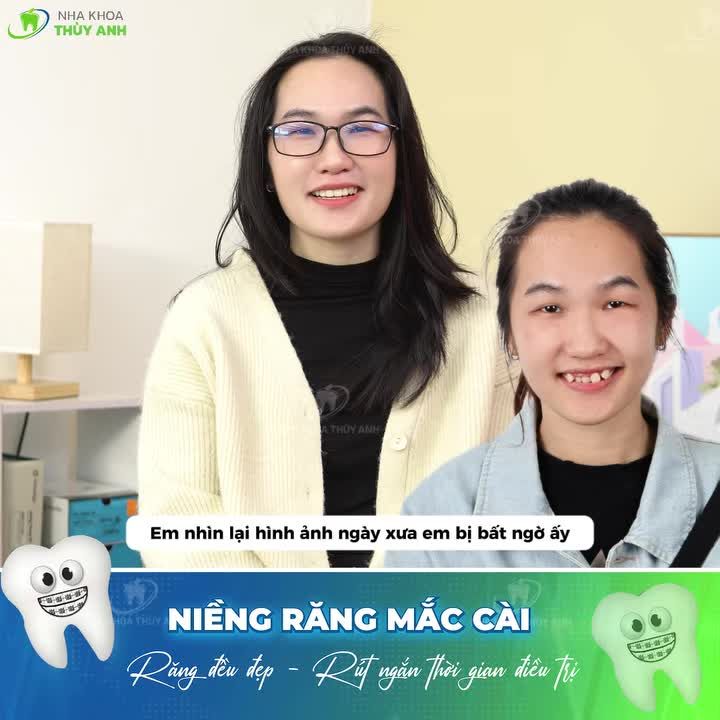 NIỀNG RĂNG XONG KHÔNG NHẬN RA BẢN THÂN MÌNH NGÀY XƯA