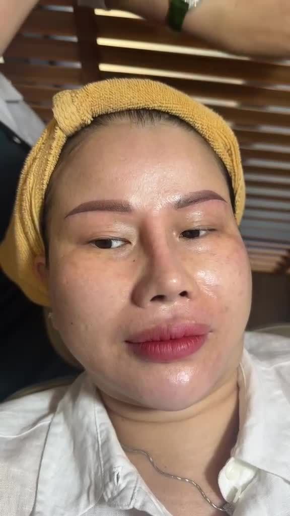 Quý cô U50 lấy lại LÀN DA SĂN CHẮC như GÁI ĐÔI MƯƠI sau Nâng cơ HIFU SMAS tại JW