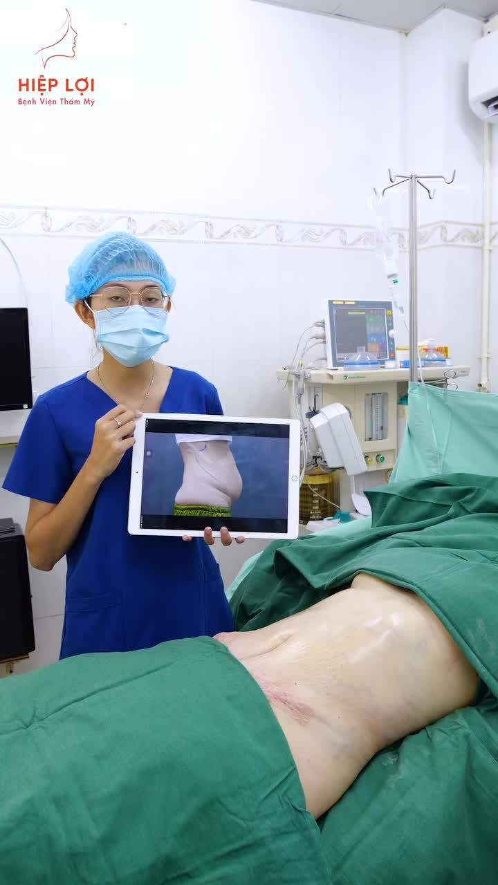 HÚT MỠ - TẶNG ĐỘ ĐÀO