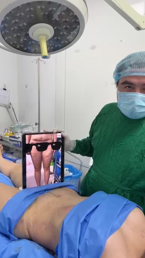 Sau lễ là phục vụ bạn gái hút dc hơn 5 lít mỡ dư với siêu combo hút mỡ bụng, đùi, cẳng chân, cắt da dư bụng, treo sa trễ và nâng ngực túi mentor 275cc !