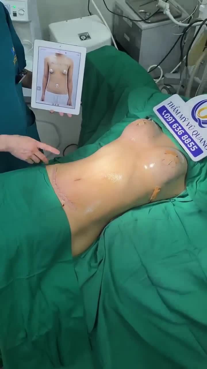 Kết quả khách hàng thực hiện combo ngực bụng