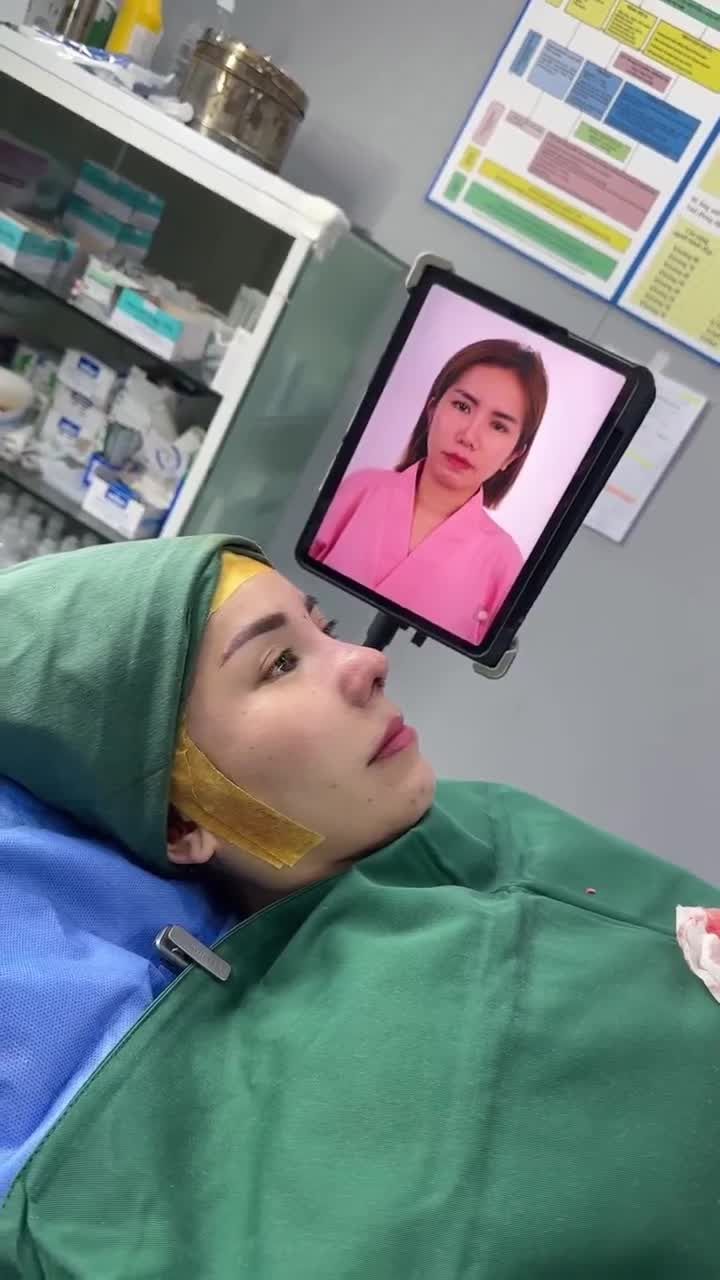 KẾT QUẢ SAU 60 PHÚT NÂNG MŨI CẤU TRÚC - SỬA LẠI MŨI HỎNG