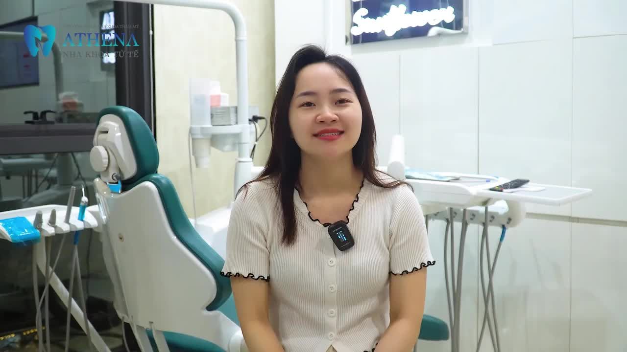 TỪ TỰ TI ĐẾN NỤ CƯỜI RẠNG RỠ – HÀNH TRÌNH LỘT XÁC SAU 2 NĂM NIỀNG RĂNG Khách hàng: Quách Thị Trang – Sinh năm 1999