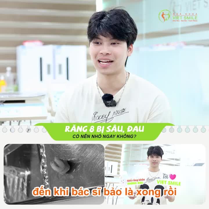 NHỔ RĂNG KHÔN SIÊU MÊ: KHÔNG ĐAU - KHÔNG ẢNH HƯỞNG CUỘC SỐNG