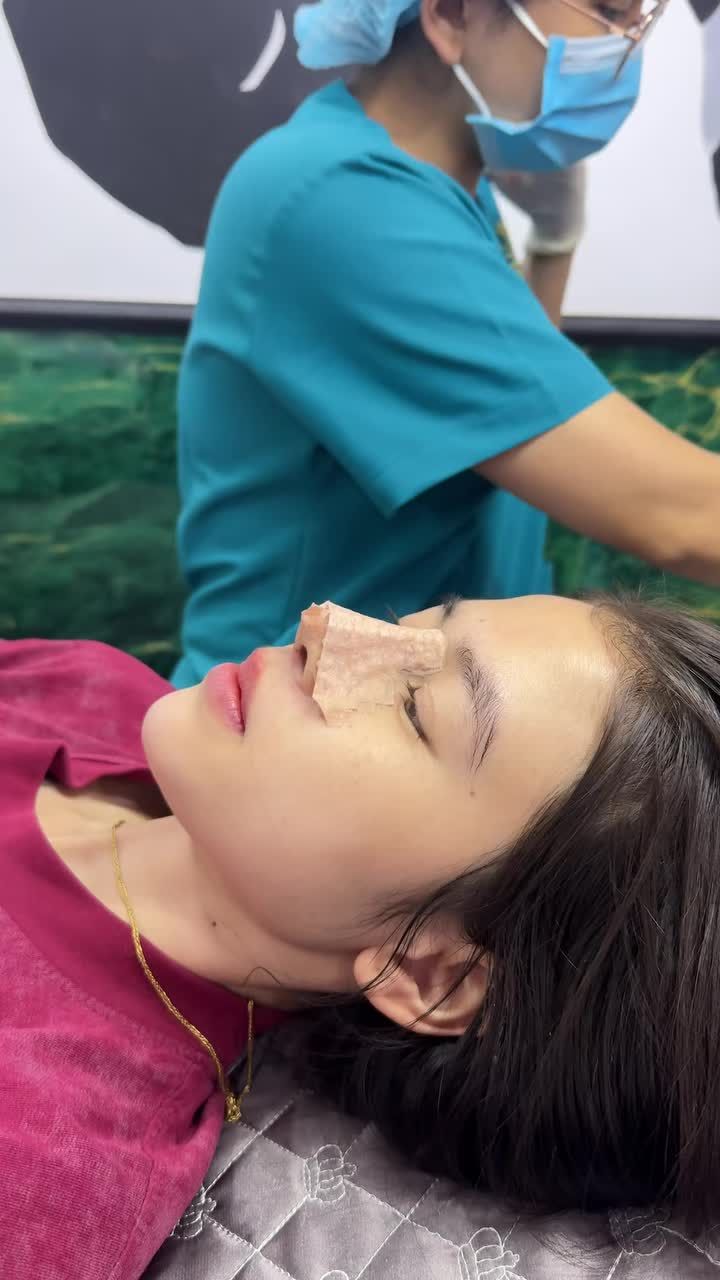 Case mũi cấu trúc được 10 ngày!