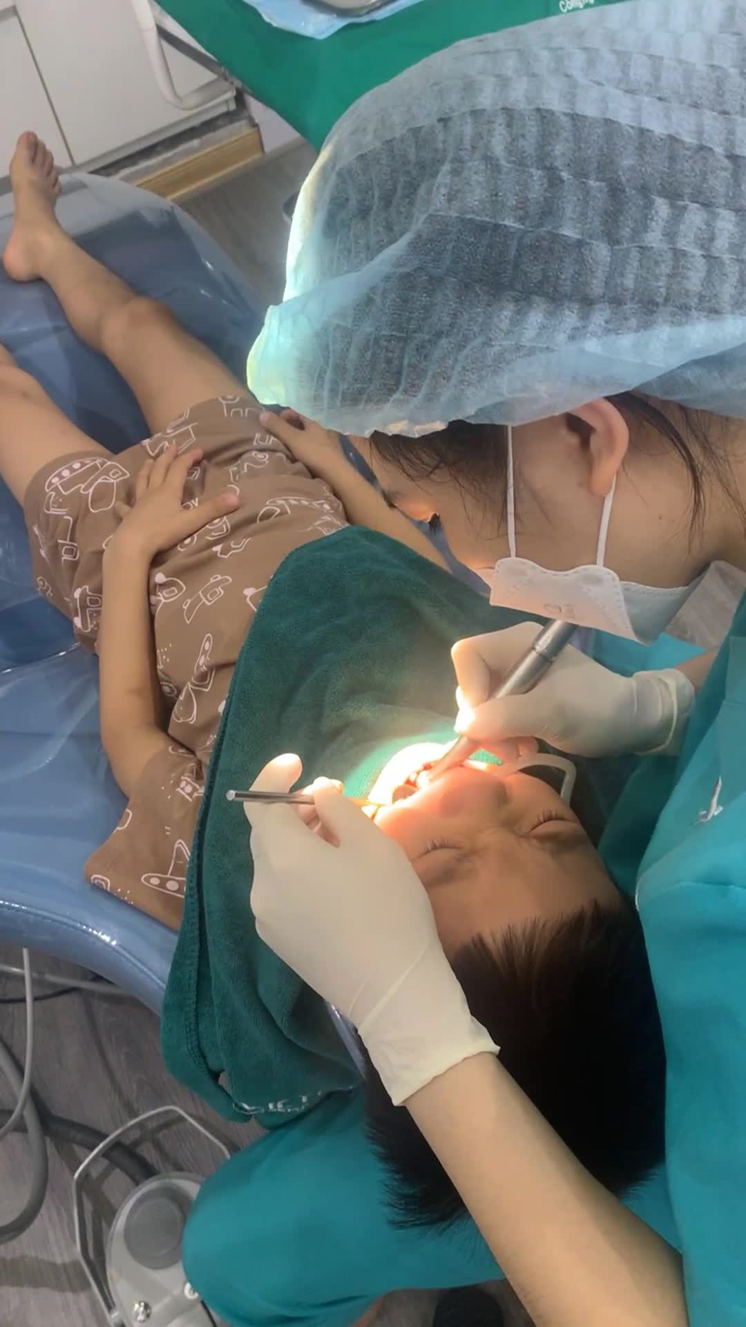 Hàn răng sữa trẻ em tại cơ sở 29 Nguyễn Du