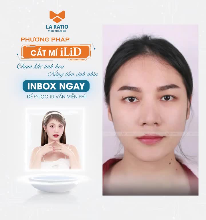 Khánh Ngân tạm biệt mắt hí nhờ cắt mí ILID tại La Ratio