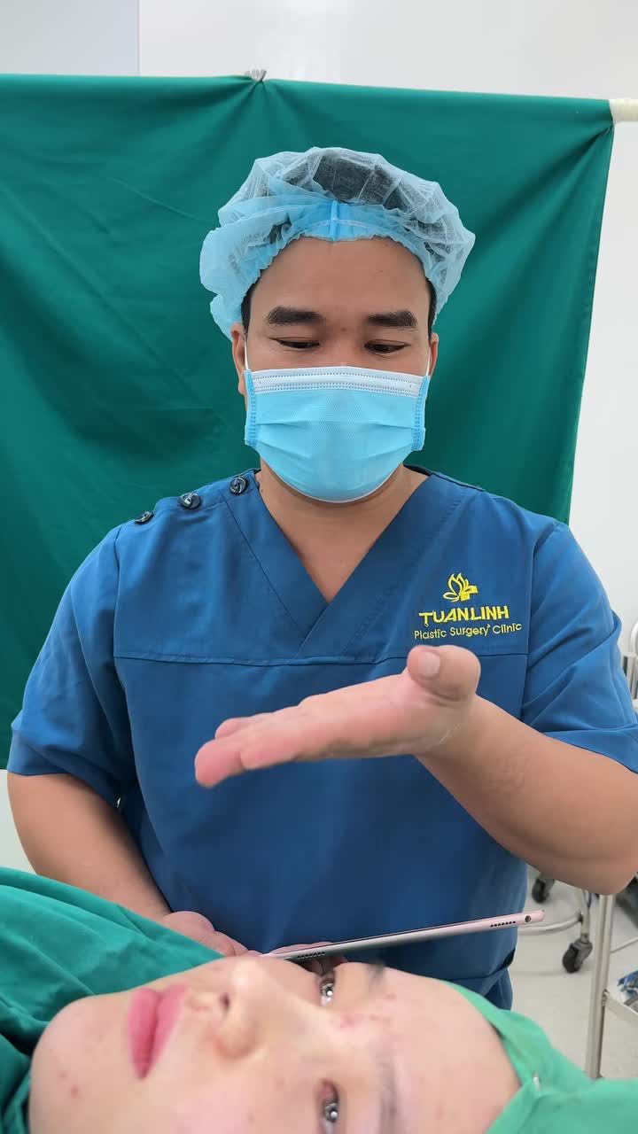 Case mũi cấu trúc surgiform vừa hoàn thành!!