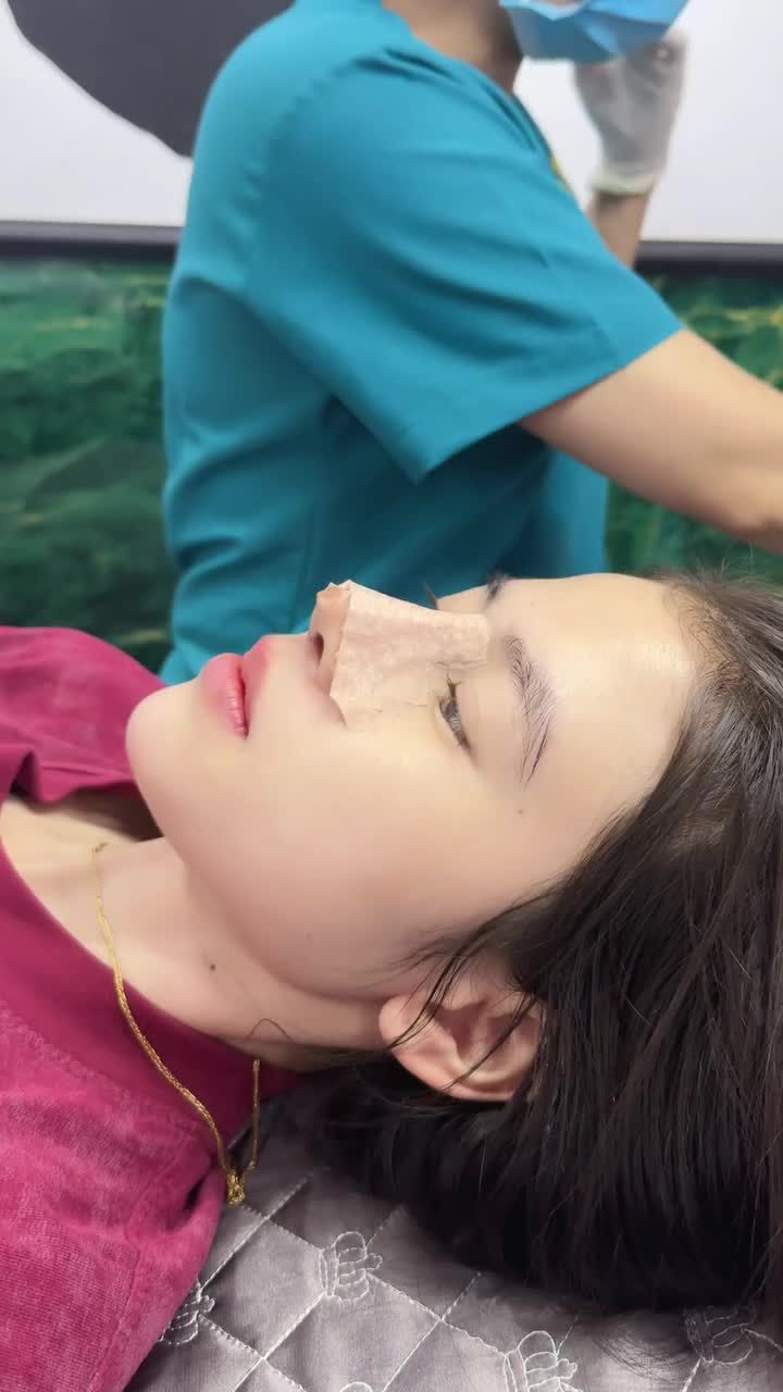 MŨI CẤU TRÚC 10 NGÀY VÀO FORM ĐẸP XUẤT SẮC!!