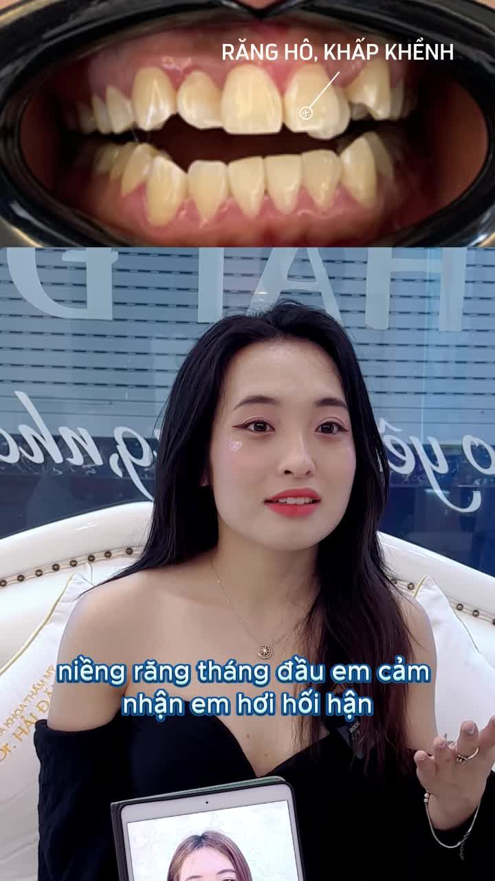 “Niềng răng không chỉ thay đổi nụ cười – mà thay đổi cả con người mình”