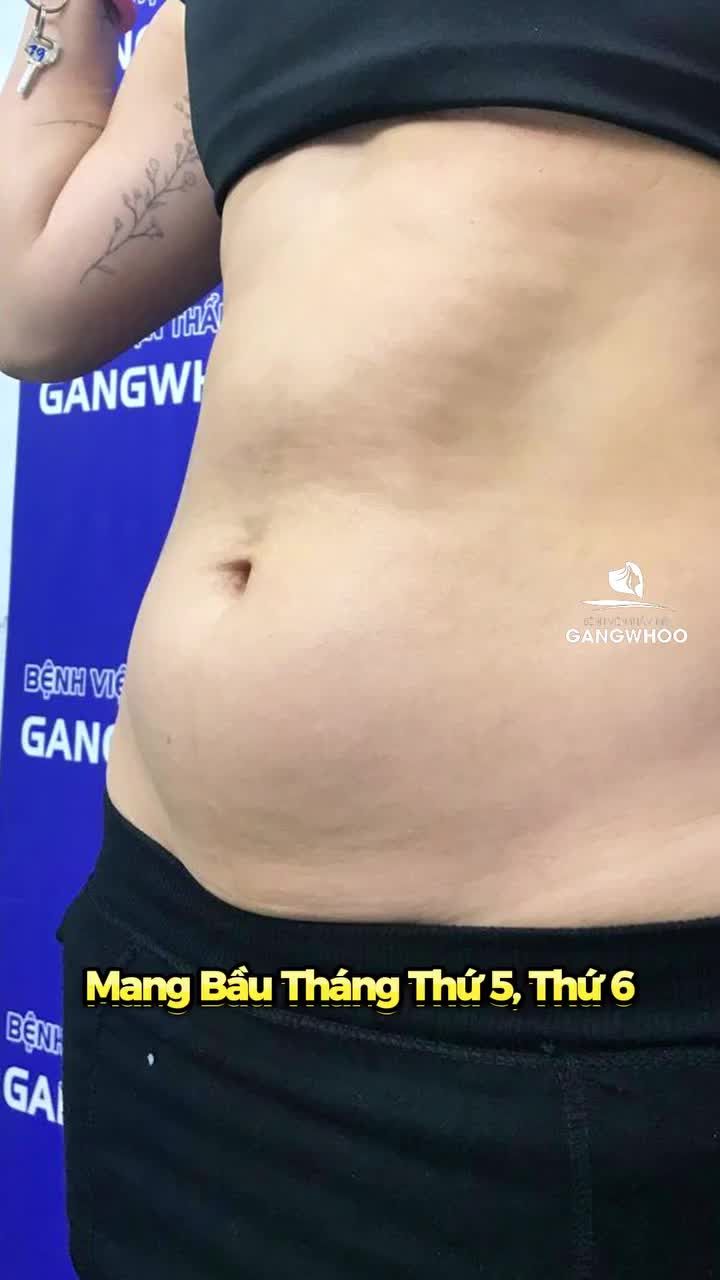 Khách hàng trải nghiệm giảm mỡ tại Gangwhoo
