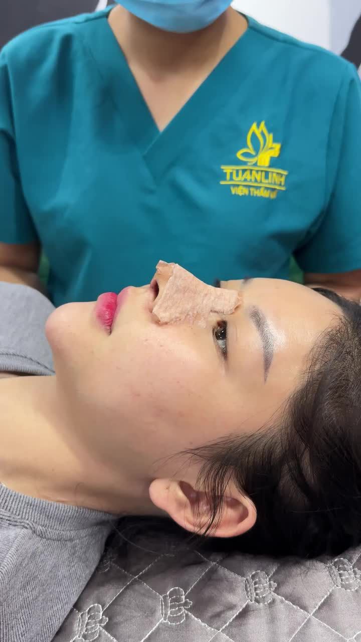 Mũi cấu trúc 10 ngày đẹp ''cực phẩm"!!