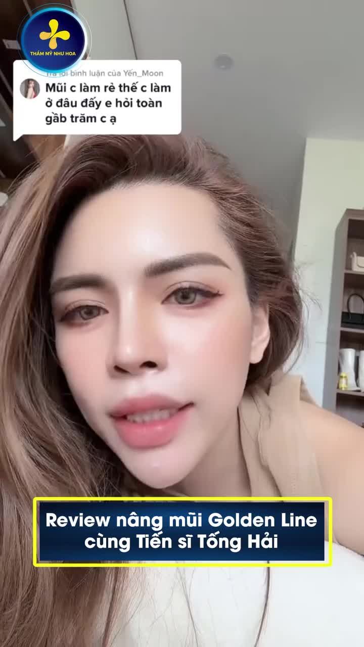 Đầu tư chỉ 35 triệu để nâng mũi Golden Line, chị đẹp Hà Thúy đã kiểm chứng: