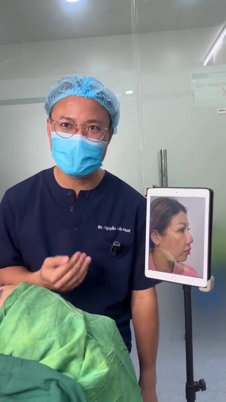 KẾT QUẢ NÂNG MŨI CẤU TRÚC SỬA LẠI