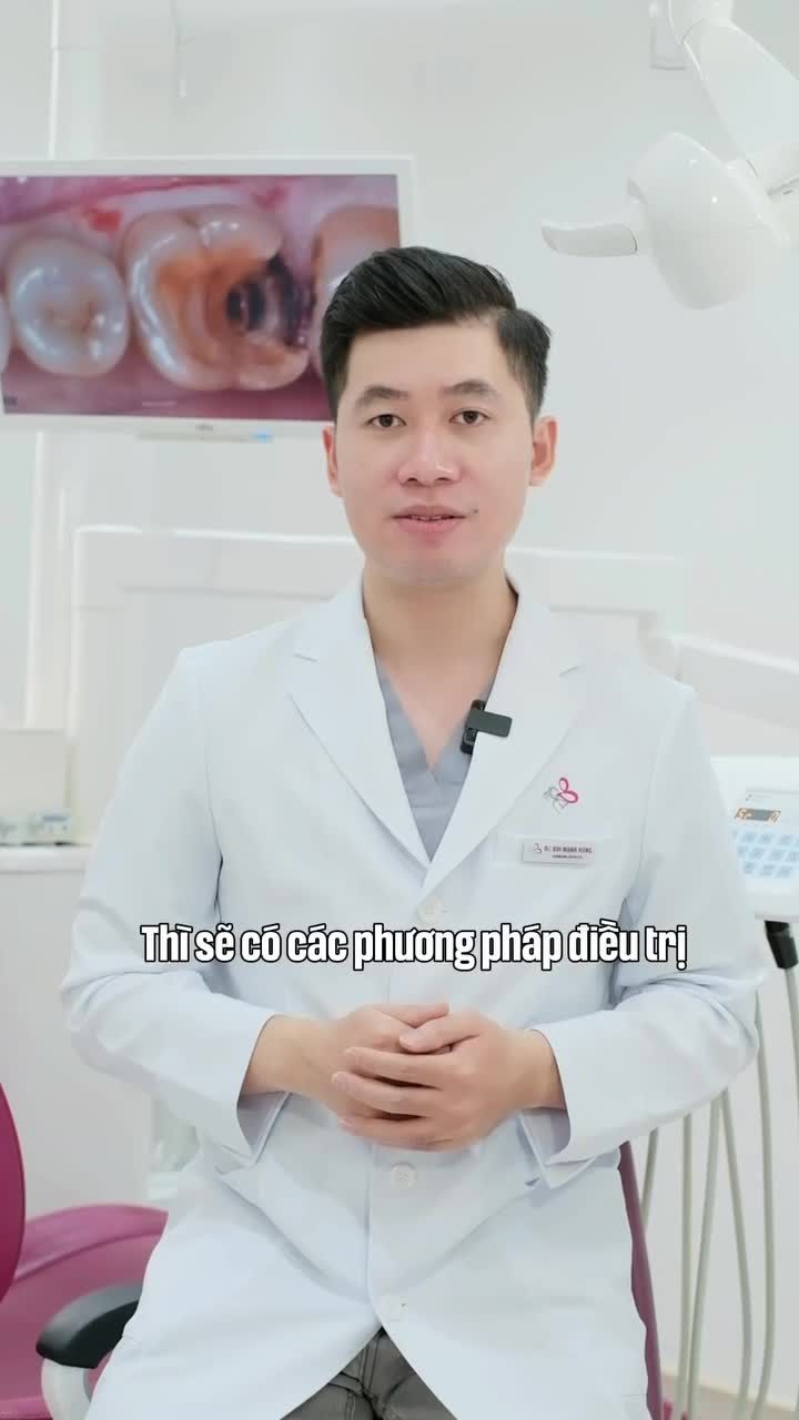 Đừng thấy răng sâu lớn mà vội vàng đi nhổ nha Vì có thể chiếc răng đó vẫn "cứu" được bằng phương pháp Inlay/Onlay/Overlay sứ.