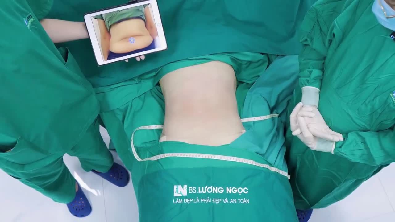 DA CHÙNG – MỠ NHIỀU NHƯNG KHÔNG CẦN CẮT DA